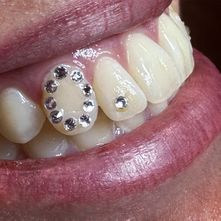 round tooth gem